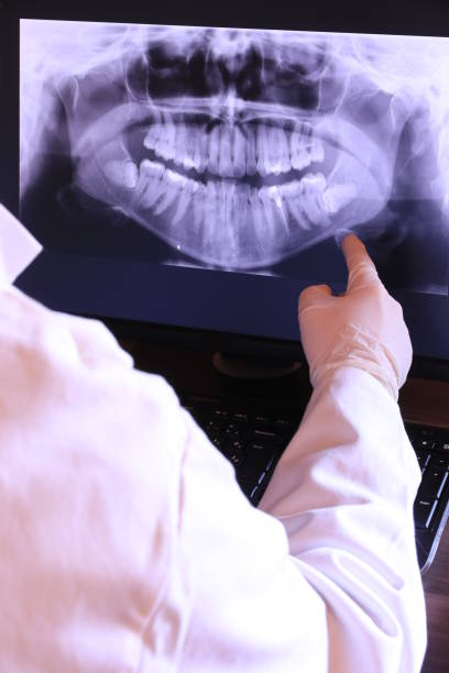Best Emergency Tooth Extraction  in San Saba, TX