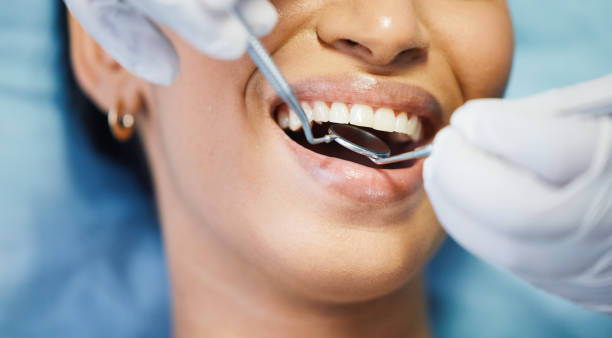 Best Dentist for Tooth Abscess  in San Saba, TX